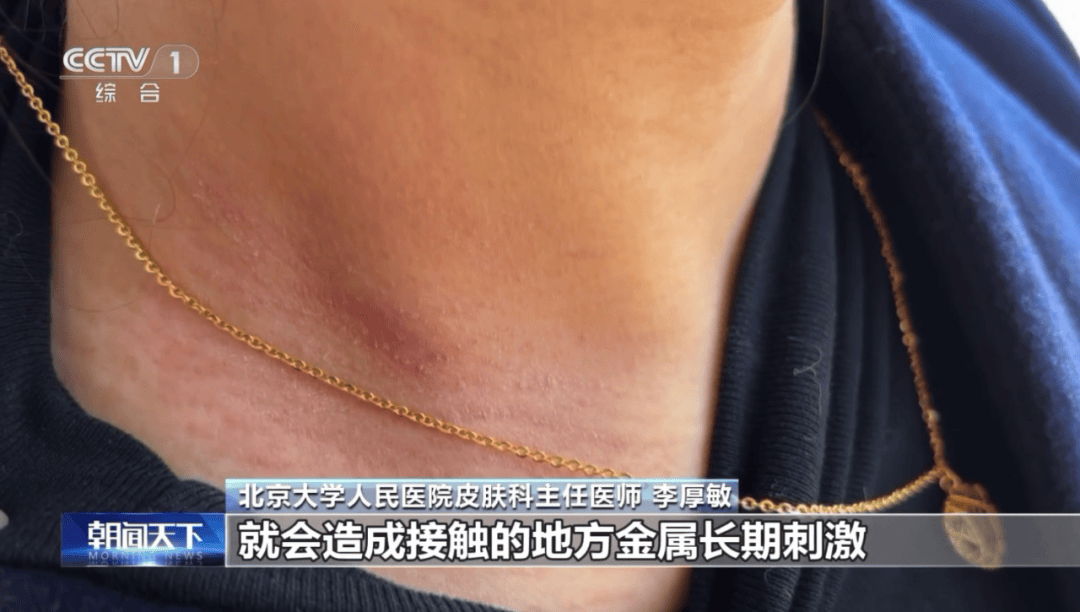 新闻多一度 | 致癌物超标9000多倍 这些“毒”首饰别再戴了